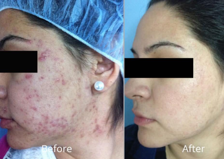 Before & after ..jpg